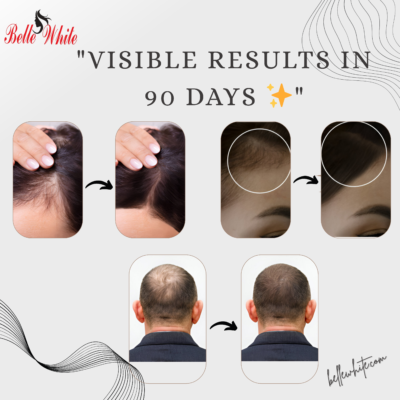 BELLE WHITE MINOXIDIL  HIAR REGROWTH    SERUM - Image 2