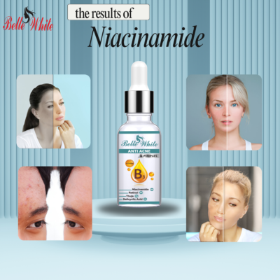 BELLE WHITE ANTI ACNE & PIMPLES   SERUM - Image 2